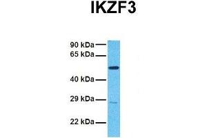 Host:  Rabbit  Target Name:  IKZF3  Sample Tissue:  Human 786-0  Antibody Dilution:  1. (IKZF3 抗体  (N-Term))