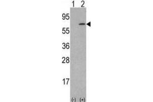 Western Blotting (WB) image for anti-Colony Stimulating Factor 1 (Macrophage) (CSF1) antibody (ABIN3002787) (M-CSF/CSF1 抗体)