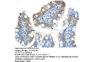 Rabbit Anti-GTPBP9 Antibody  Paraffin Embedded Tissue: Human Intestine Cellular Data: Epithelial cells of intestinal villas Antibody Concentration: 4. (OLA1 抗体  (N-Term))