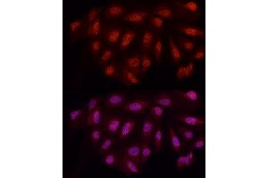 Immunofluorescence analysis of U2OS cells using WTAP Rabbit pAb (ABIN7271372) at dilution of 1:50 (40x lens). (WTAP 抗体  (AA 1-396))