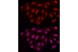 Immunofluorescence analysis of U2OS cells using WTAP Rabbit pAb (ABIN7271372) at dilution of 1:50 (40x lens). (WTAP 抗体  (AA 1-396))