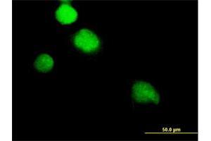 Immunofluorescence of purified MaxPab antibody to NEK2 on HeLa cell. (NEK2 抗体  (AA 1-445))