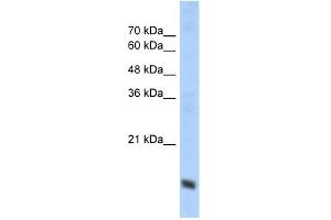 WB Suggested Anti-COX4I1 Antibody Titration:  1. (COX IV 抗体  (N-Term))