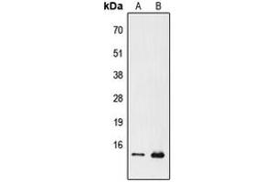 Western blot analysis of PFDN1 expression in Jurkat (A), Raw264. (PFDN1 抗体  (N-Term))