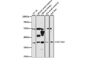 Western blot analysis of extracts of various cell lines, using SLC10A2 antibody (ABIN6292276) at 1:3000 dilution. (SLC10A2 抗体)