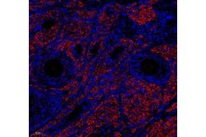 Immunofluorescence of paraffin embedded rat ovary using EMCN (ABIN7073818) at dilution of 1: 600 (180x lens) (Endomucin 抗体)