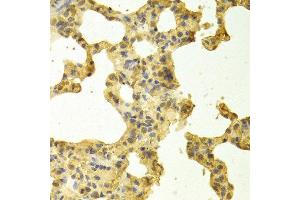 Immunohistochemistry of paraffin-embedded rat lung using TRADD antibody at dilution of 1:100 (x400 lens). (TRADD 抗体)