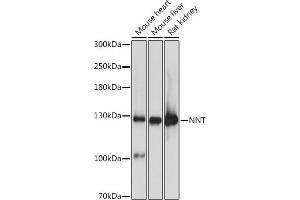 Western blot analysis of extracts of various cell lines, using NNT antibody (ABIN1681070, ABIN3019052, ABIN3019053 and ABIN6220687) at 1:3000 dilution. (NNT 抗体  (AA 881-1086))