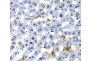 Immunohistochemistry of paraffin-embedded Rat liver using NR0B2 Polyclonal Antibody at dilution of 1:100 (40x lens). (NR0B2 抗体)