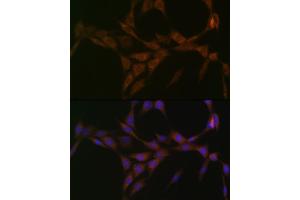 Immunofluorescence analysis of NIH-3T3 cells using 15-PGDH/HPGD Rabbit mAb (ABIN7267807) at dilution of 1:100 (40x lens). (HPGD 抗体)
