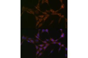 Immunofluorescence analysis of NIH-3T3 cells using 15-PGDH/HPGD Rabbit mAb (ABIN7267807) at dilution of 1:100 (40x lens). (HPGD 抗体)