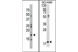 Image no. 1 for anti-Nucleoside diphosphate kinase B (NME2) (N-Term) antibody (ABIN360545) (NME2 抗体  (N-Term))