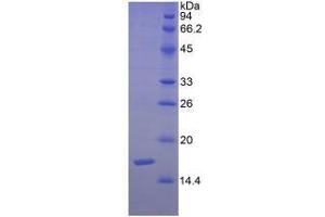 SDS-PAGE analysis of Human Semaphorin 3F Protein. (SEMA3F 蛋白)