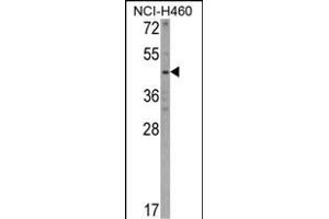 Western blot analysis of KYNU Antibody (C-term) (ABIN390735 and ABIN2841003) in NCI- cell line lysates (35 μg/lane). (KYNU 抗体  (C-Term))
