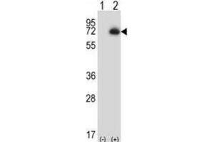 Western Blotting (WB) image for anti-Carboxypeptidase N Subunit 2 (CPN2) antibody (ABIN2997205) (CPN2 抗体)