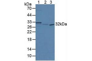 Western blot analysis of (1) Mouse Brain Tissue, (2) Mouse Pancreas Tissue and (3) Human HeLa cells. (SCGN 抗体  (AA 1-276))