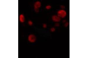 ABIN6274270 staining HuvEc cells by IF/ICC. (ETV1 抗体  (N-Term))