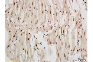 Formalin-fixed and paraffin embedded rat heart labeled with Anti-Nkx2. (Nkx2.5/ Cardiac-Specic Homeobox 1 (AA 85-180) 抗体)