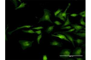 Immunofluorescence of purified MaxPab antibody to CTNND1 on HeLa cell. (CTNND1 抗体  (AA 1-610))