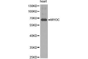 Western Blotting (WB) image for anti-Myocilin (MYOC) (AA 245-504) antibody (ABIN3022197) (MYOC 抗体  (AA 245-504))