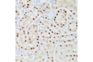 Immunohistochemistry of paraffin-embedded rat kidney using ADK Rabbit pAb  at dilution of 1:350 (40x lens). (ADK 抗体  (AA 200-345))
