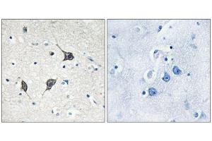 Immunohistochemistry analysis of paraffin-embedded human brain tissue using GPR20 antibody. (GPR20 抗体  (C-Term))