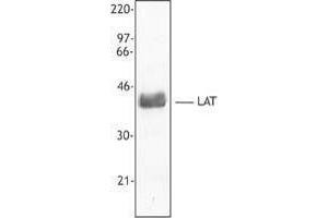 Western Blotting (WB) image for anti-Linker For Activation of T Cells (LAT) antibody (ABIN2666080) (LAT 抗体)