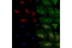ABIN6259644 and ABIN6266603 staining  cells by IF/ICC.