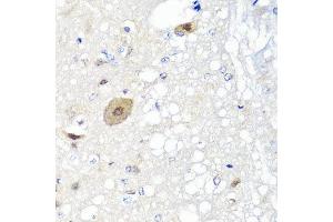 Immunohistochemistry of paraffin-embedded rat brain using FGF13 antibody at dilution of 1:100 (x40 lens). (FGF13 抗体)