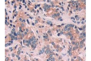 Immunohistochemistry (IHC) image for anti-Keratin 6C (KRT6C) (AA 163-482) antibody (ABIN7443299)