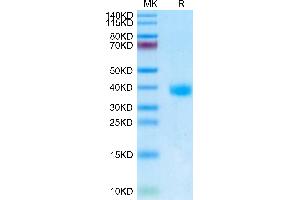 SDS-PAGE (SDS) image for SARS-CoV-2 Spike (BA.2 - Omicron), (RBD) protein (His tag) (ABIN7273901)
