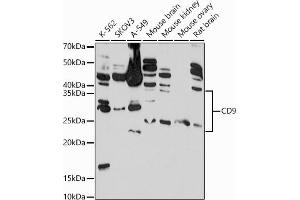 Western blot analysis of extracts of various cell lines, using CD9 antibody  at 1:1000 dilution. (CD9 抗体  (AA 112-195))