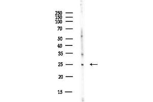 anti-TFIIF antibody