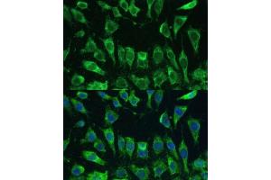 Immunofluorescence analysis of L-929 cells using Galectin 3/Galectin 3/LG antibody (ABIN6130437, ABIN6143158, ABIN6143159 and ABIN7101422) at dilution of 1:100. (Galectin 3 抗体  (AA 1-250))