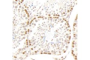 Immunohistochemistry analysis of paraffin-embedded mouse testis using,GSTT1 (ABIN7074091) at dilution of 1: 2000 (GSTT1 抗体)