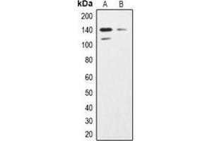 Western blot analysis of SHIP2 expression in K562 (A), Hela (B) whole cell lysates. (INPPL1 抗体)