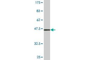 Western Blot detection against Immunogen (47. (SAR1A 抗体  (AA 1-198))