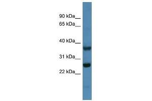 Western Blotting (WB) image for anti-ATP Synthase, H+ Transporting, Mitochondrial Fo Complex, Subunit B1 (ATP5F1) (N-Term) antibody (ABIN928241)
