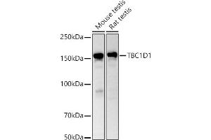 Western blot analysis of extracts of various cell lines, using TBC1D1 antibody (ABIN6129487, ABIN6148878, ABIN6148879 and ABIN6225024) at 1:1000 dilution. (TBC1D1 抗体  (AA 520-710))