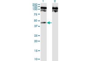 Western Blot analysis of TNFRSF19 expression in transfected 293T cell line by TNFRSF19 monoclonal antibody (M02), clone 1H6. (TNFRSF19 抗体  (AA 30-119))