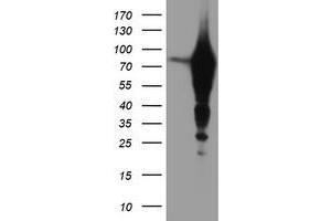 Western Blotting (WB) image for anti-Epsin 2 (EPN2) antibody (ABIN1498049) (Epsin 2 抗体)