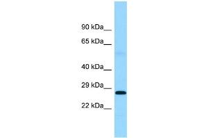 WB Suggested Anti-FTMT Antibody Titration: 1. (Ferritin Mitochondrial 抗体  (Middle Region))