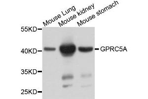 Western blot analysis of extract of various cells, using GPRC5A antibody. (GPRC5A 抗体)