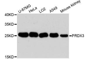 Western blot analysis of extracts of various cell lines, using PRDX3 antibody. (Peroxiredoxin 3 抗体  (AA 63-256))
