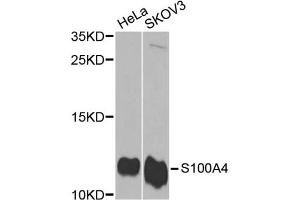 Western blot analysis of extracts of various cell lines, using S100A4 antibody (ABIN5970801) at 1/1000 dilution. (s100a4 抗体)