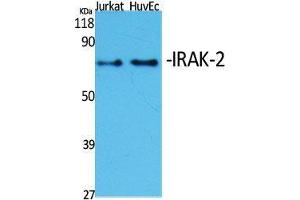Western Blot (WB) analysis of specific cells using IRAK-2 Polyclonal Antibody.