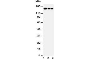 Western blot testing of MRP1 antibody and Lane 1:  Jurkat;  2: CEM;  3: A549 (MRP1 抗体)