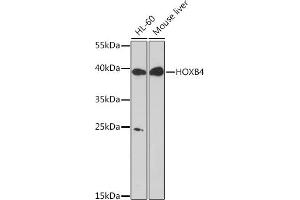 Western blot analysis of extracts of various cell lines, using HOXB4 Rabbit pAb (ABIN7267768) at 1:1000 dilution. (HOXB4 抗体  (AA 50-150))