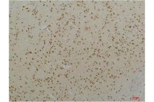 Immunohistochemistry (IHC) analysis of paraffin-embedded Mouse Brain Tissue using Cav1. (CACNA1C 抗体)