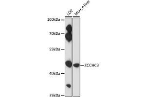 Western blot analysis of extracts of various cell lines, using ZCCHC3 antibody (ABIN7271543) at 1:3000 dilution. (ZCCHC3 抗体  (AA 215-335))